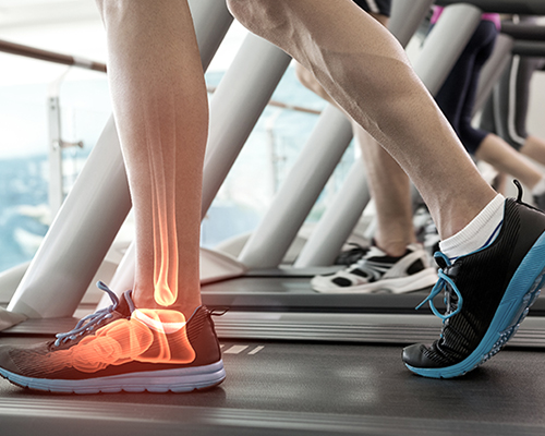 sports physiotherapy