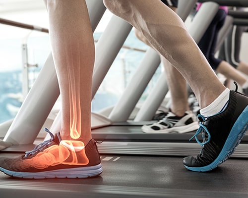best physio in bishoptown